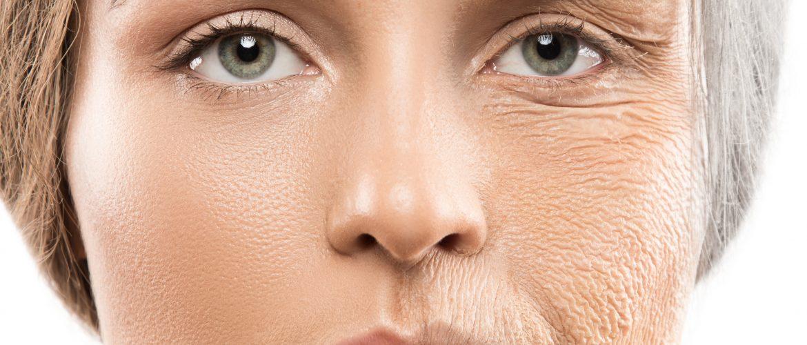 Ameliyatsız Cilt Germe