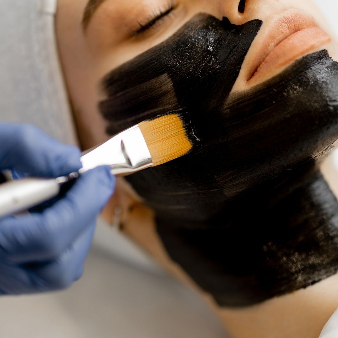 Karbon Peeling Faydaları