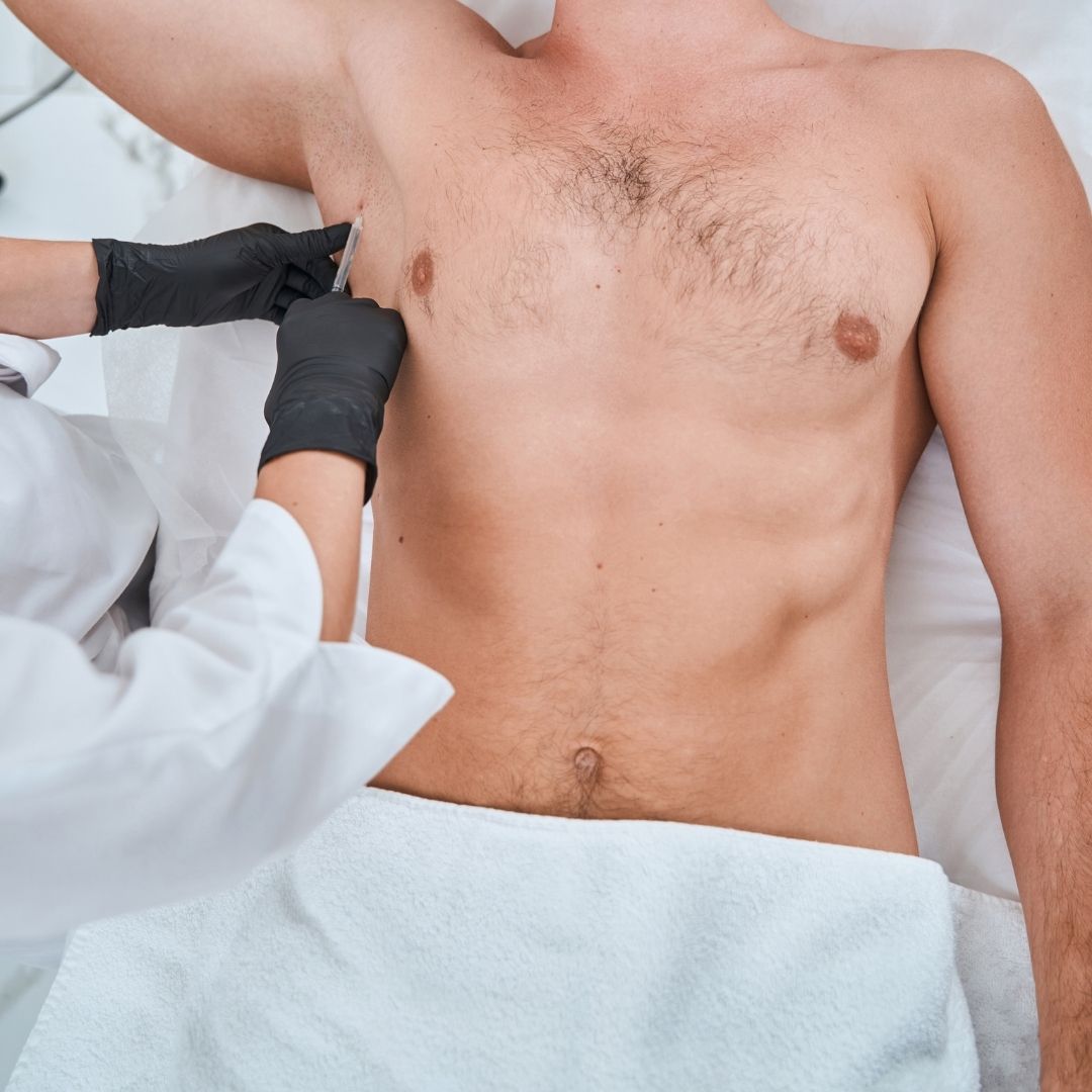 Terleme Tedavisinde Botoks