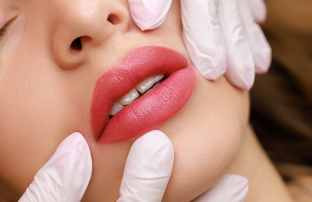 Dudak Şekillendirmede Hangi Dolgu Teknikleri Kullanılır