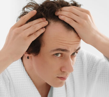 FUE Yöntemi ile Saç Ekimi Nedir